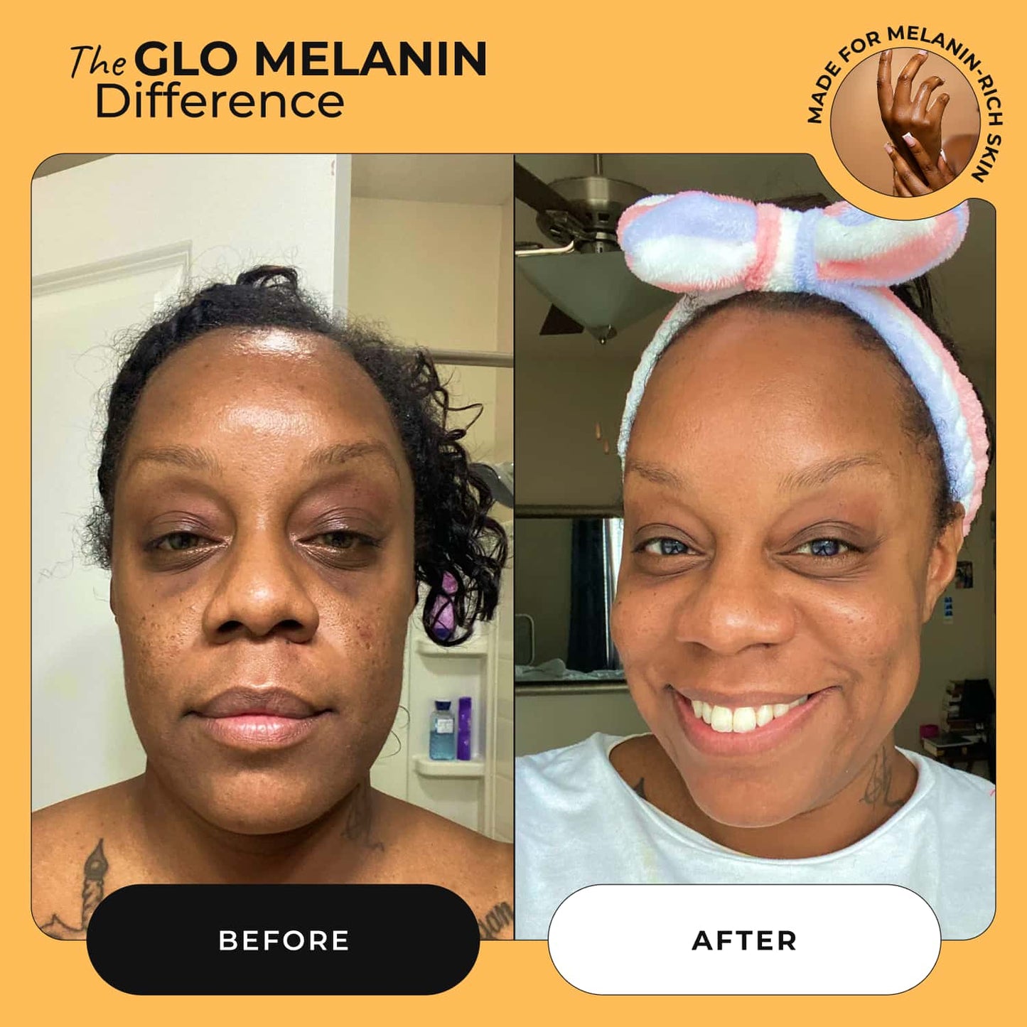 Melanin Skin Bundle (40% off)