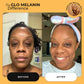 Melanin Skin Bundle (40% off)