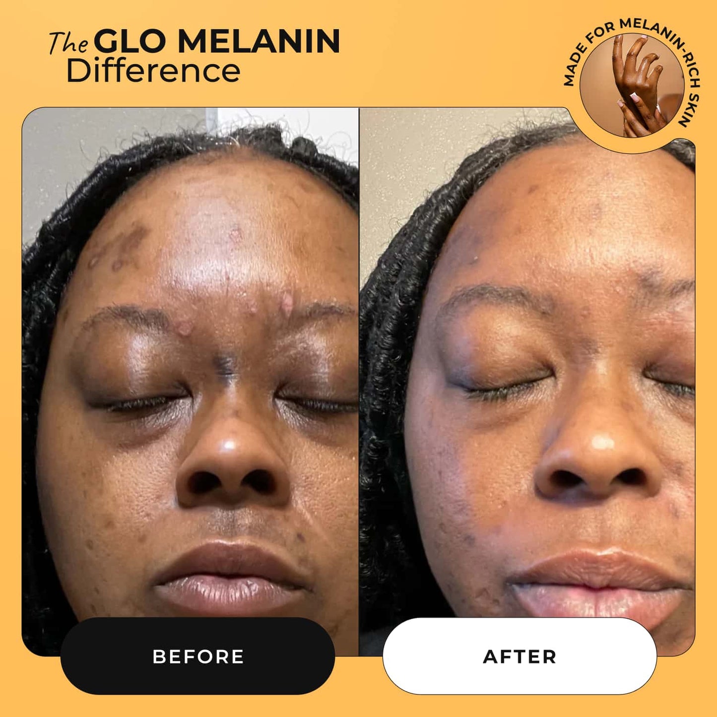 Melanin Skin Bundle (40% off)