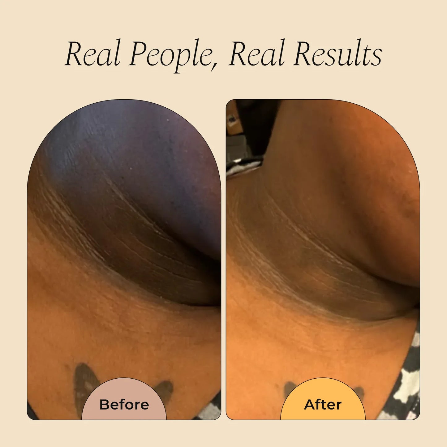 Body Brightening Bundle