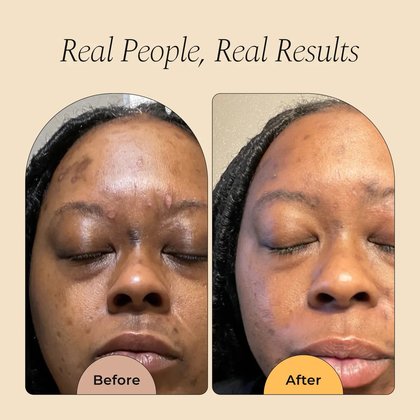 Dark Spot Corrector Serum