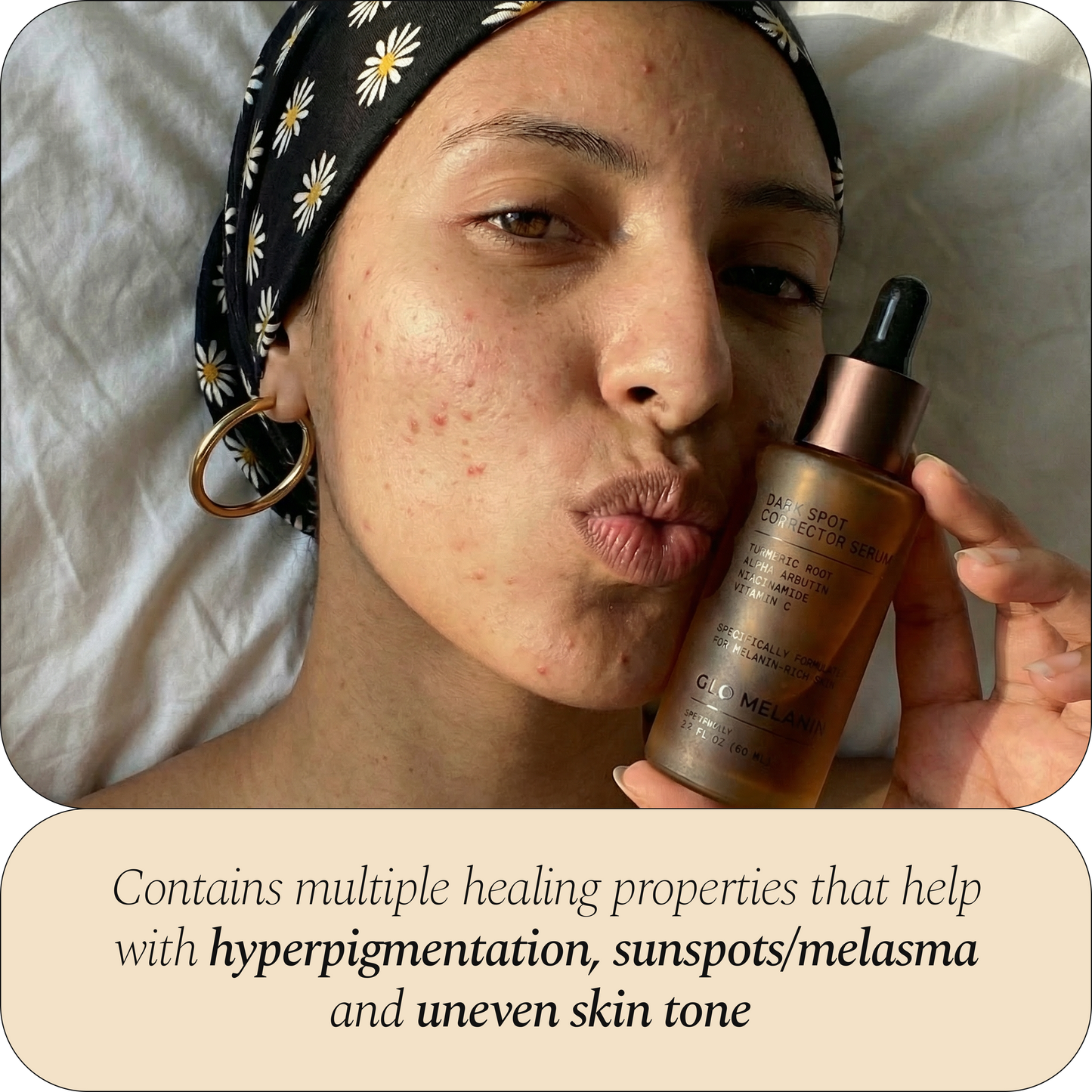 Dark Spot Corrector Serum