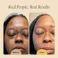 Melanin Skin Bundle